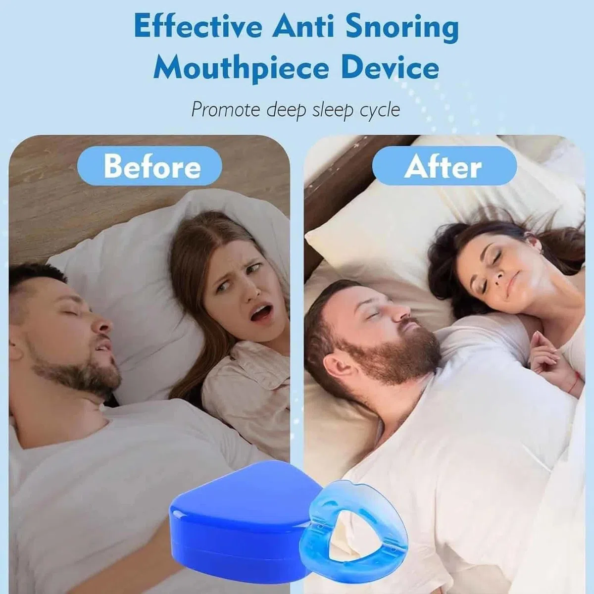 YUNFAN Anti Snoring Mouthpiece - Universal Size,Anti Snoring Devices for Sleep,Food Grade Material Snore Mouth Guard,Instantly Quiet Antisnoring Device Mouthpiece,Make The Night Quiet(2)