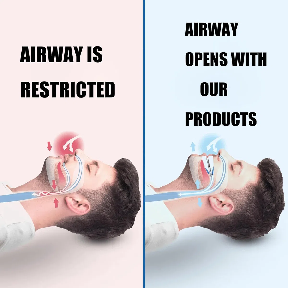 Airflow Anti Ronquidos,helio Airflow Antironquidos,férula Antironquidos,airflow Antironquidos,aparato Apneas Del Sueño,Ajustable Dispositivos Anti Ronquidos,para Hombres Mujeres Sueño Natural